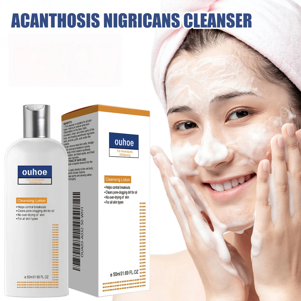 Brightening Facial Cleanser Remove Acne Dark Spots Melanin Oil Control Skin Cleansing Face Wash Blackhead Remover Face Cleaner Oasis Select
