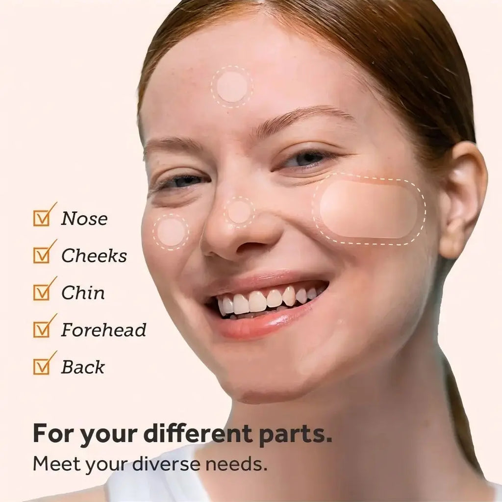 Hydrogel acne removing patch (2 shapes), 190/380 pieces/box, deep cleaning acne removing patch, effective acne removing patch Oasis Select