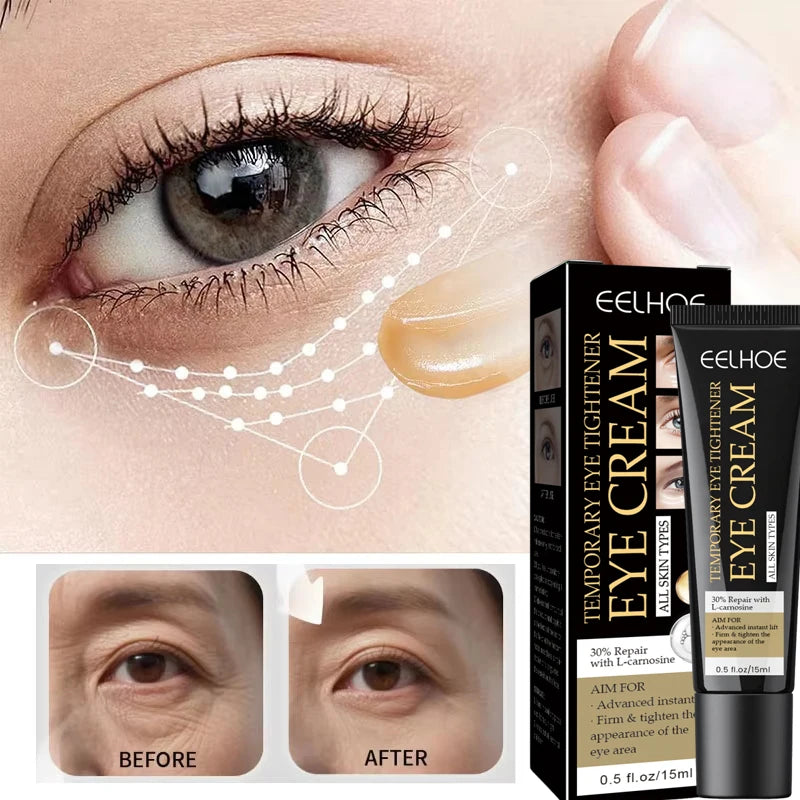 Retinol Eye Cream – Firming, Dark Circle & Hydrating 15ml Eye Cream Oasis Select