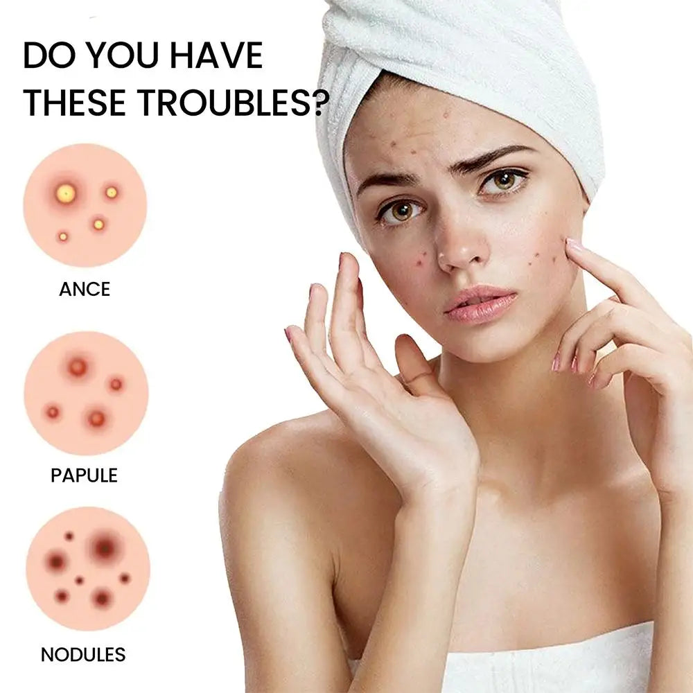 200pcs Star Shape Pimple Patches Colorful Hydrocolloid Pimple Healing Sticker Cute Strong Absorption Zit Patches Face Care Oasis Select
