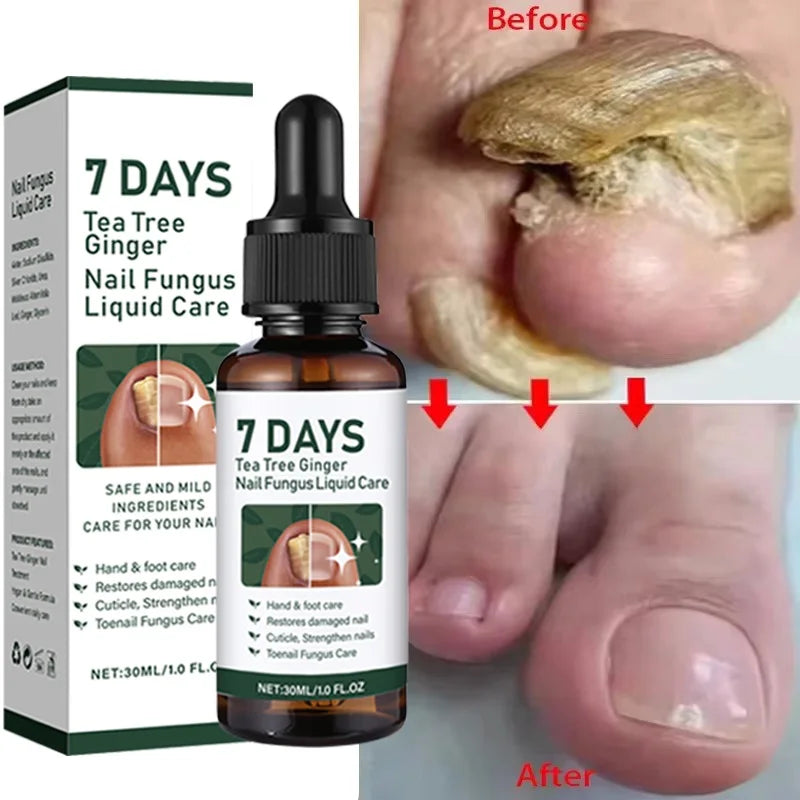 Eelhoe Nail Repair Serum – Ginger Extract for Healthy Nails Nail Repair Serum Oasis Select 1PCS 1