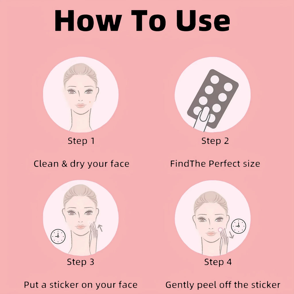 9 Hitworker microneedle acne patches. 24-hour protection, invisible coverage, non irritating tea tree oil essence, suitable for Oasis Select