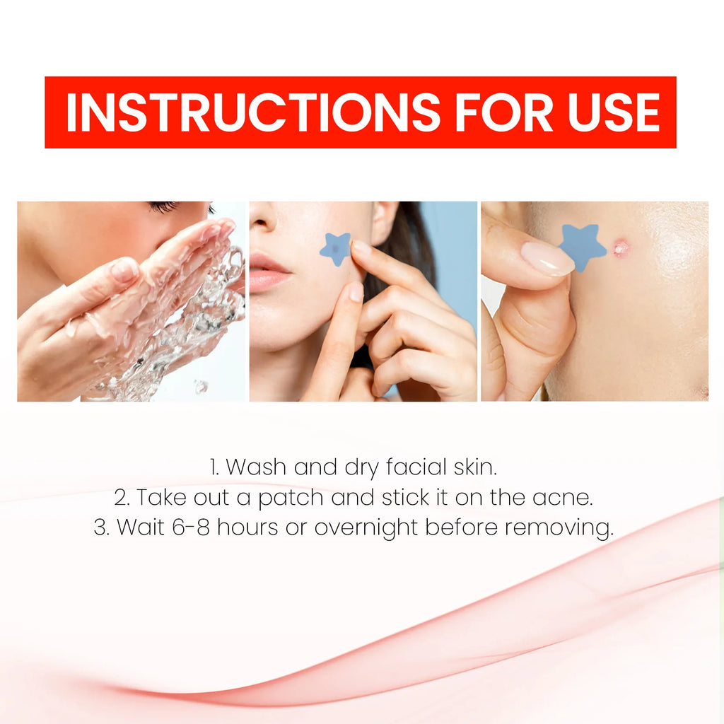 JAYSUING Facial Acne Patch Improve Inflammation Remove Acne Cleanning Dirt Shrink Pores Relieve Discomfort Facial Soothing Patch Oasis Select