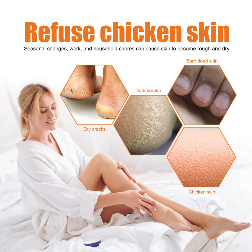Orange Oil Foot Peeling Spray Exfoliate Rough Skin Soften Heels Repairing Dry Cracks Smoothing Foot Skins Feet Exfoliating Spray Oasis Select