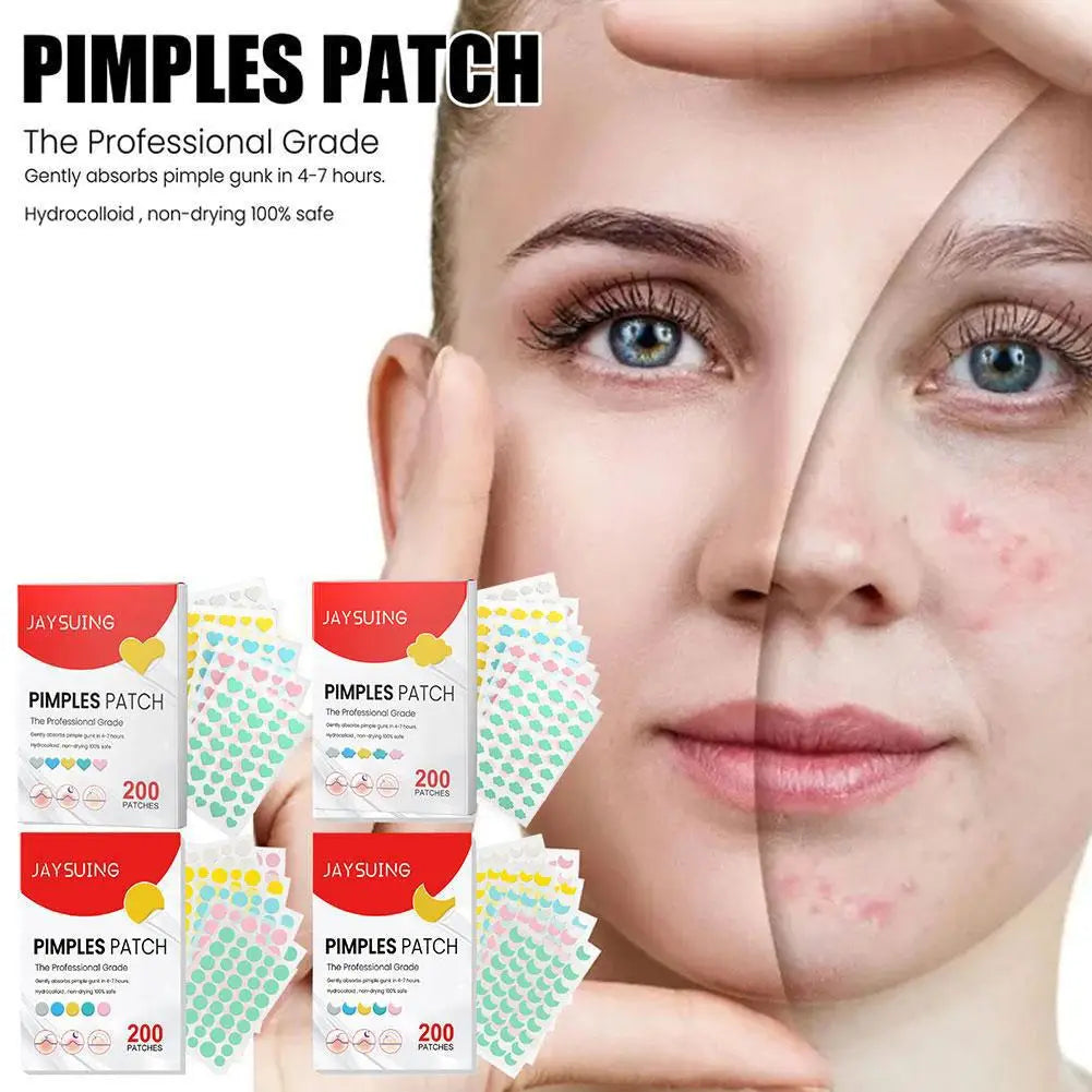 200pcs Hydrocolloid Acne Patches – Pimple & Blemish Cover Acne Patch Oasis Select