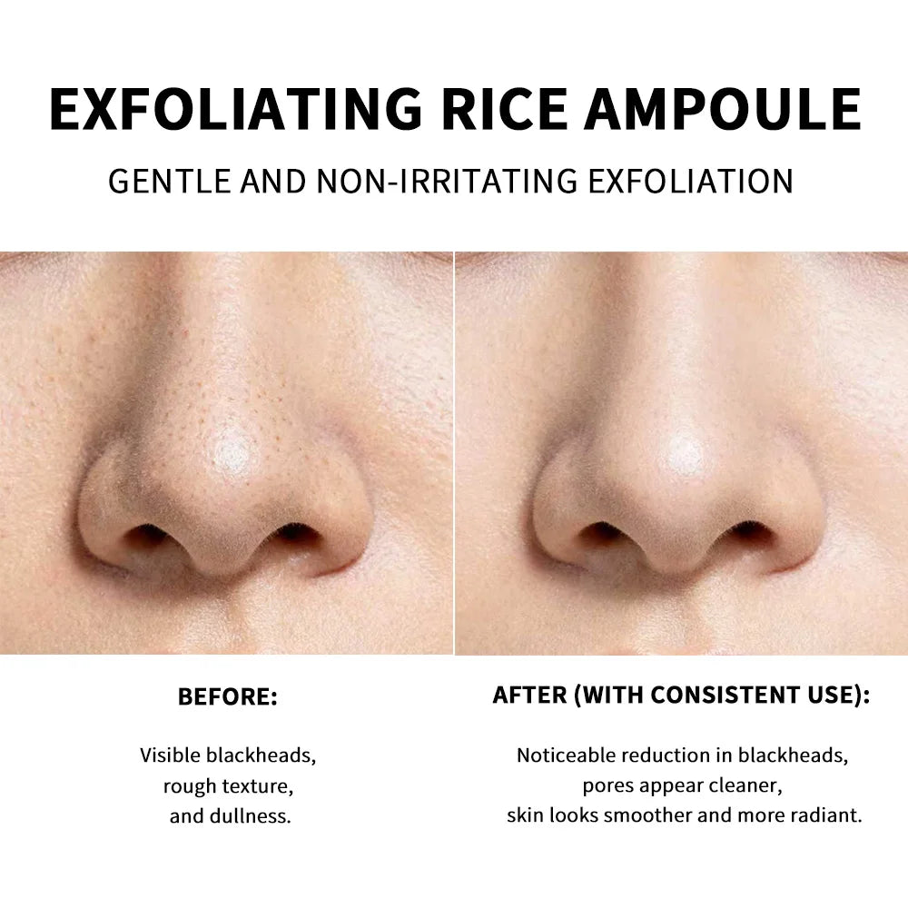 Rice Peeling Ampoule Soft Exfoliating Face and Body Scrub Dead Skin Cells Blackhead Remover for All Skin Types korean skin care Oasis Select