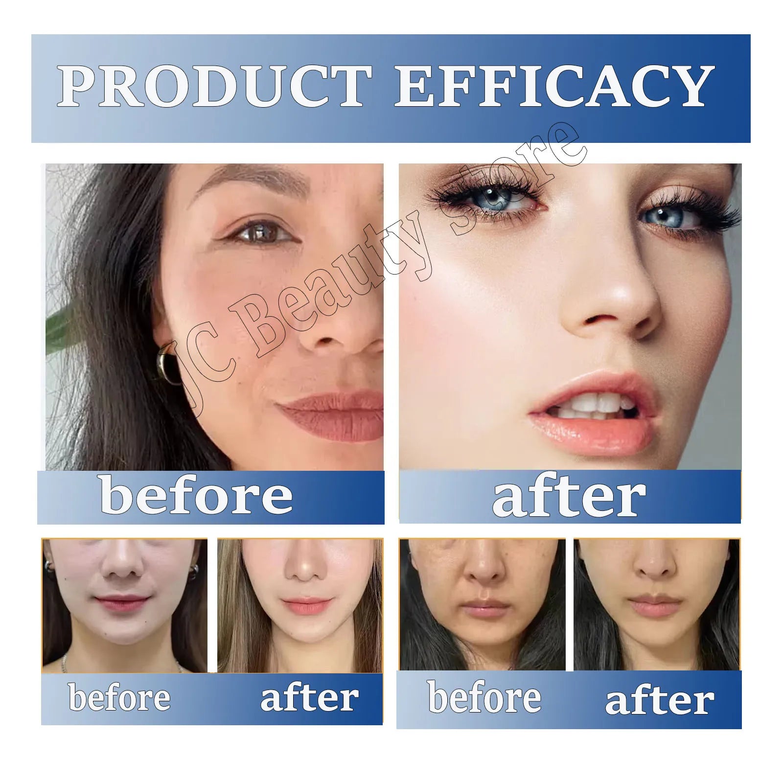 Collagen & Retinol Overnight Wrinkle Patches – Firm & Lift