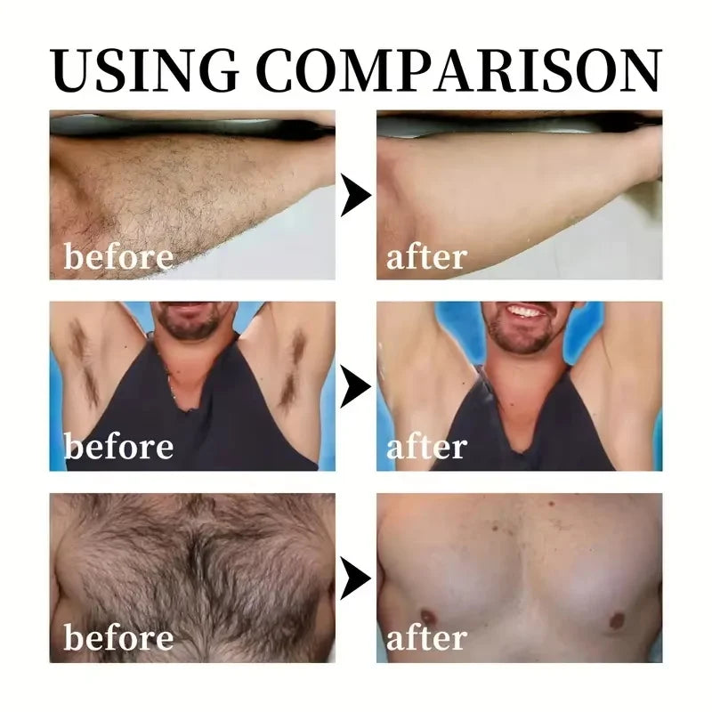 SADOER 3-Min Hair Removal Cream | Face, Body & Intimate Areas Hair Removal Cream Oasis Select