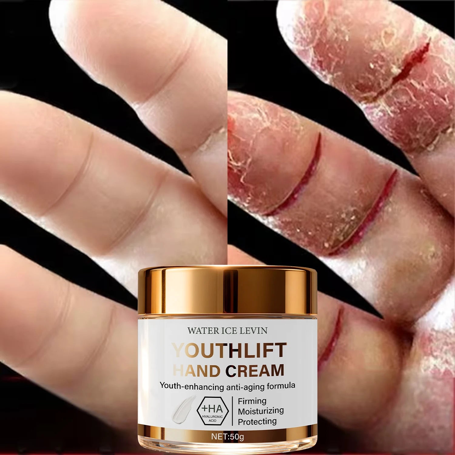 YouthLift Anti-Aging Hand Cream – HA & Retinol, 50g Anti-Aging Hand Cream Oasis Select