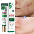 Tea Tree Facial Gel Cream – Oil Control & Blemish Care