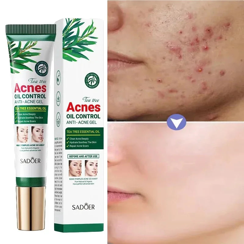 Tea Tree Facial Gel Cream – Oil Control & Blemish Care