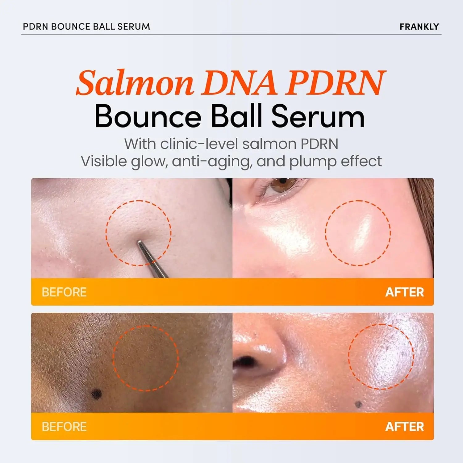 Salmon DNA Collagen Peptide Face Cream | Korean Moisturizer 50g