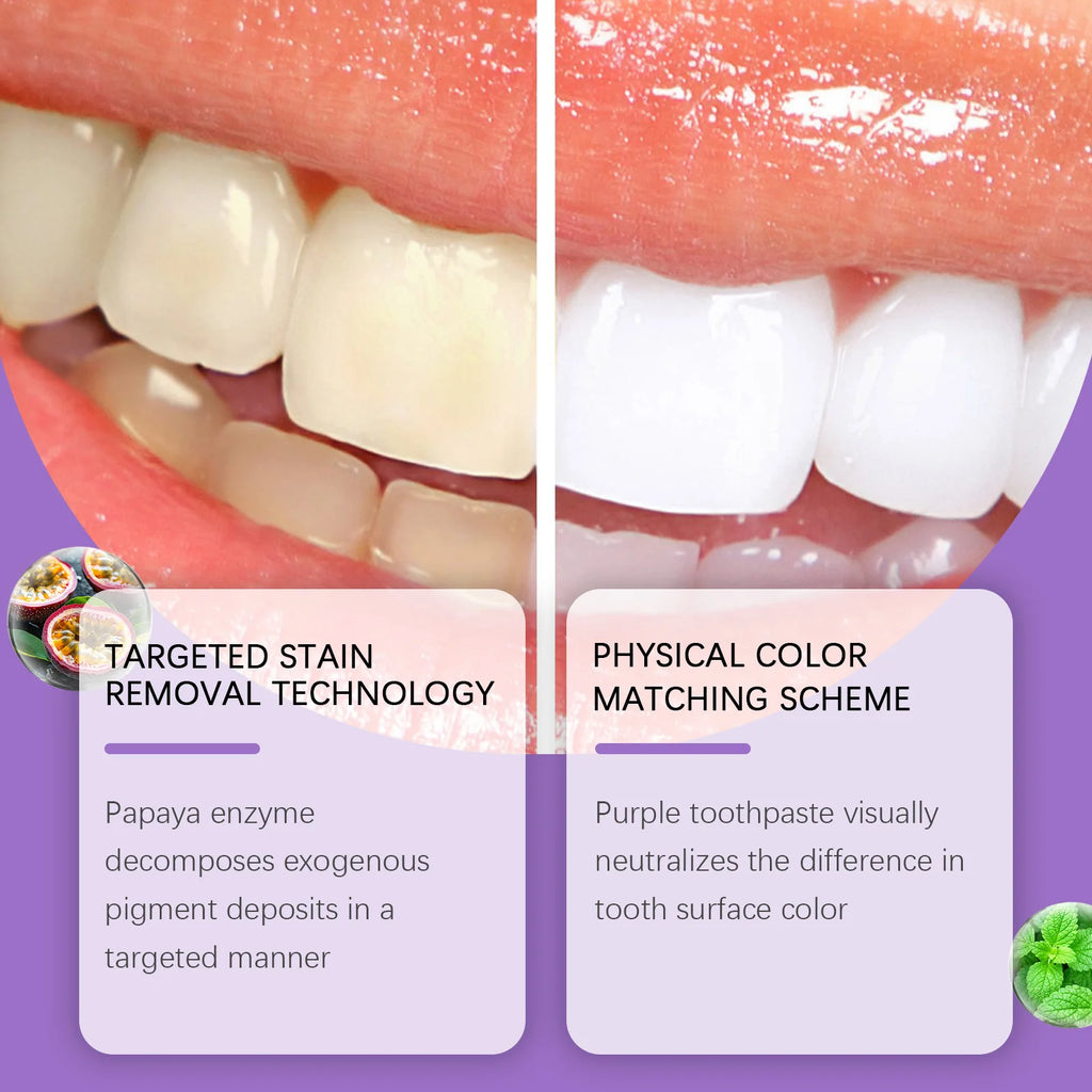 Hydroxyapatite Mint Toothpaste Daily Gentle Care Purple Toothpaste Physical Color Adjustment Fresh And Clean Yellow Teeth 114g Oasis Select