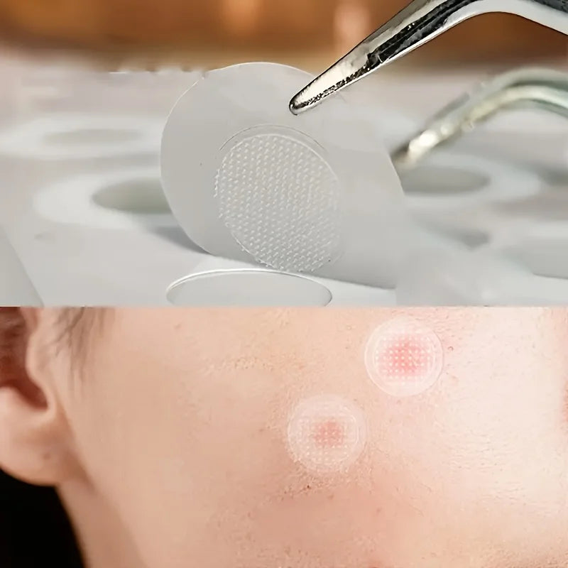 9 Hitworker microneedle acne patches. 24-hour protection, invisible coverage, non irritating tea tree oil essence, suitable for Oasis Select