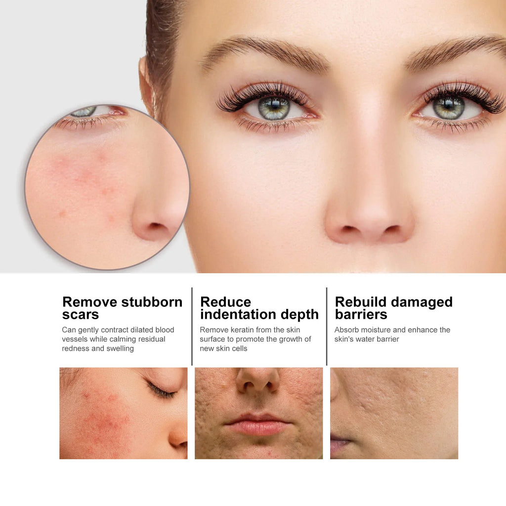 EELHOE Anti-Aging Face Serum – Firming, Pore Minimizing, 50ml Anti-Aging Face Serum Oasis Select