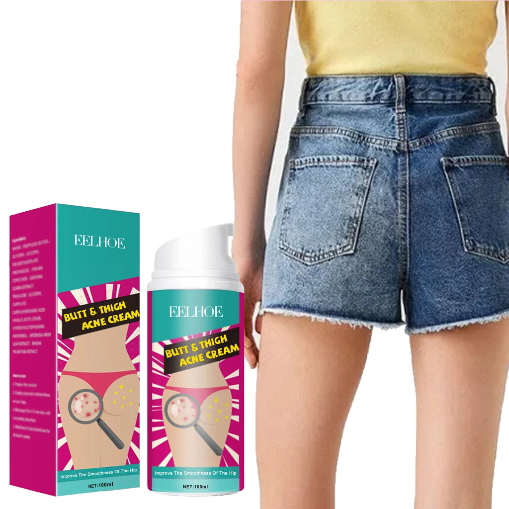Butt Thigh Acne Cream Remove Pimples Moisturizing Clarifying Brightening Smoothing Skin Care Thigh Acne Removal Cream Oasis Select