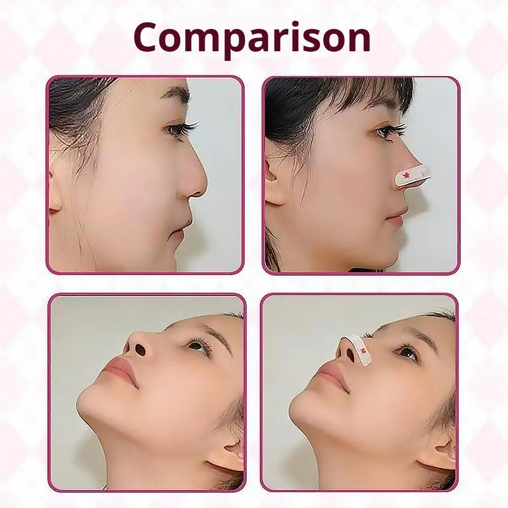 Reusable Nose Lift Strips – Reshaping & Contouring Tape Nose Reshaping Strips Oasis Select