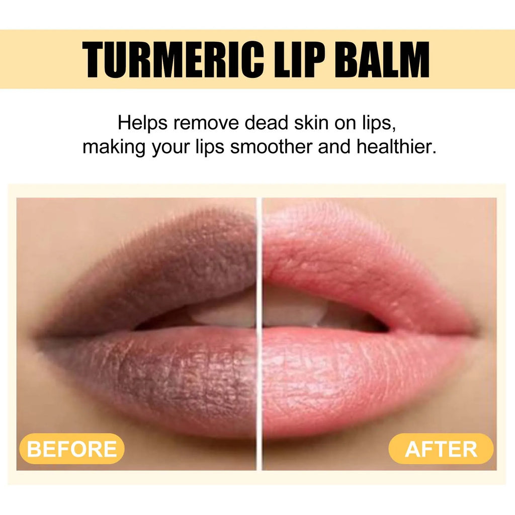 Eelhoe Turmeric Lip Balm – Darkness Removal & Moisturizing Turmeric Lip Balm Oasis Select