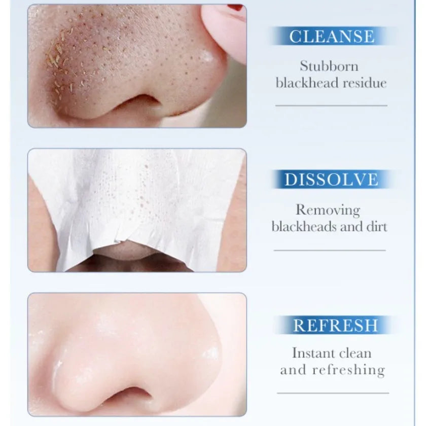 SADOER Blackhead Remover Nose Mask Shrink Pores Improve acne Deep Nose Cleansing Skin Care Oasis Select