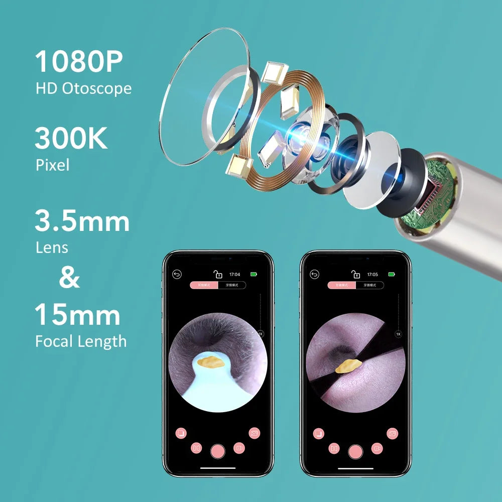 Visual Ear Cleaner with HD Camera & Wi-Fi – Borescope Ear Kit
