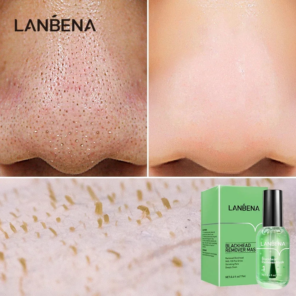 LANBENA Blackhead Remover Mask + Shrinks Pore Serum (Step 1+Step 2) Facial Acne Treatment 17ml Oasis Select