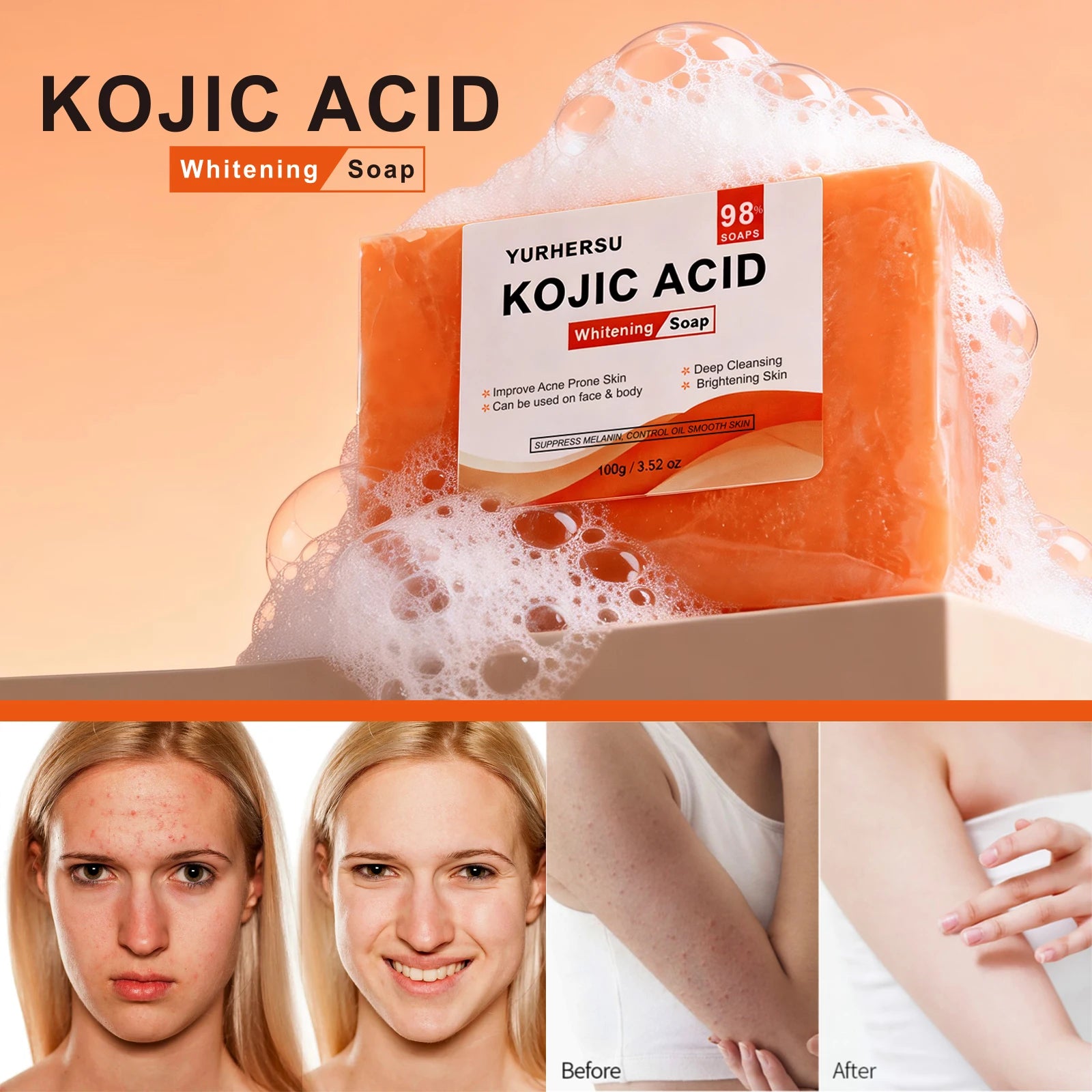 Kojic Acid Brightening Face Soap – Natural Moisturizing Cleanser Brightening Facial Soap Oasis Select