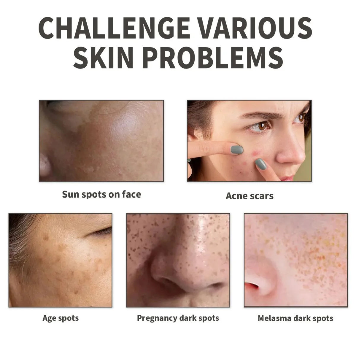 TRSTAY Vitamin B5 Serum Hydrated Serum+Hyaluronic Acid, Improves Skin Dullness Oasis Select