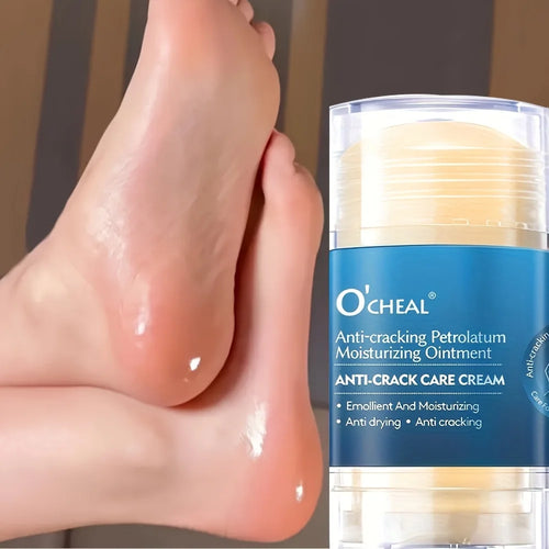 Anti-Crack Foot Cream for Dry & Cracked Heels – Moisturizer Foot Cream Oasis Select