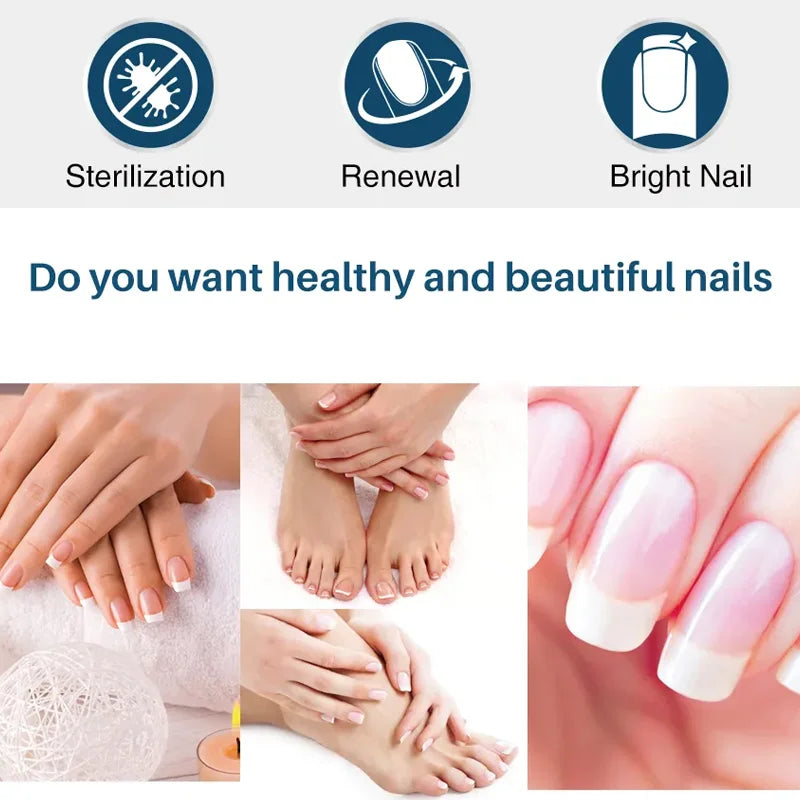 YUITIKUE Ginger King Nail Care Cream – 7-Day Results, 60g