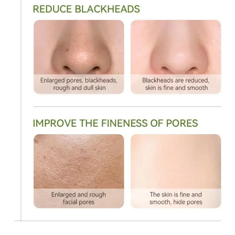 LAIKOU Green Tea Clay Mask 100g – Oil Control & Pore Minimizing