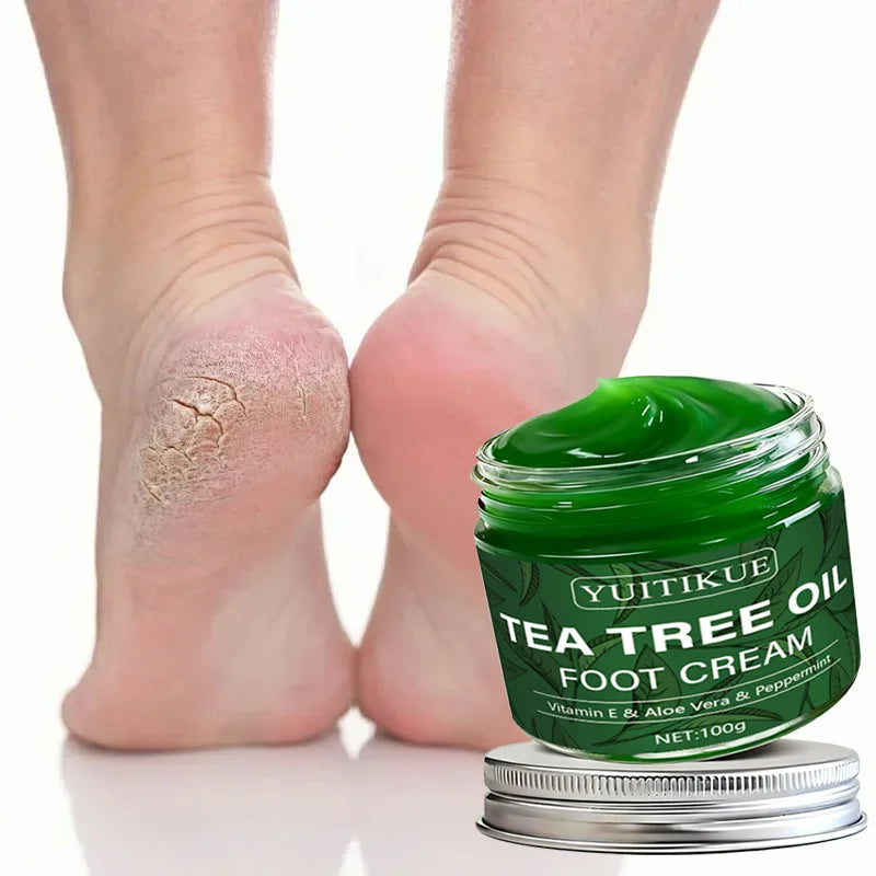 YUITIKUE Tea Tree Oil Foot Cream – Vitamin E & Aloe 100g