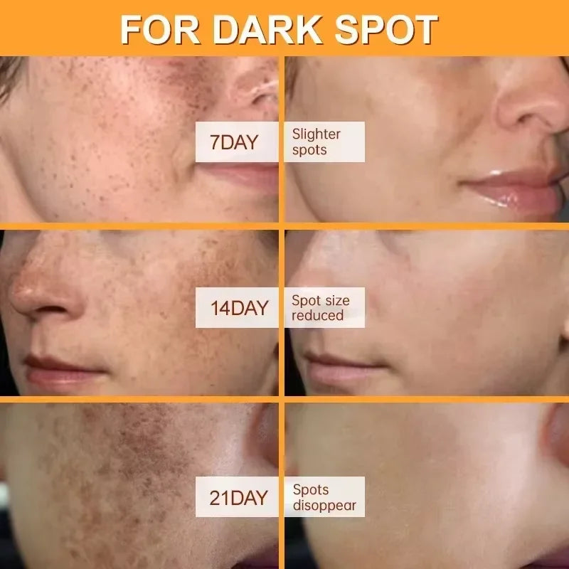 Brightening Face Cream – Dark Spot Corrector & Pigmentation