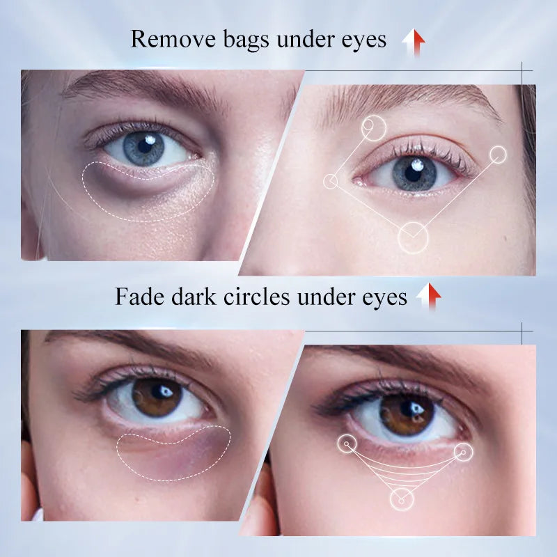 Kojic Acid & Retinol Eye Cream – Brightening & Firming Eye Cream Oasis Select