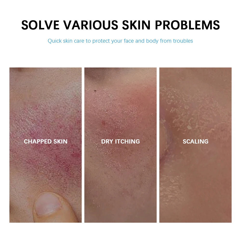 Soothing Multi-Purpose Hydrating Cream Reduces Redness Daily Helps Relieve Rough Cracked Skin Deep Skin Care Oasis Select