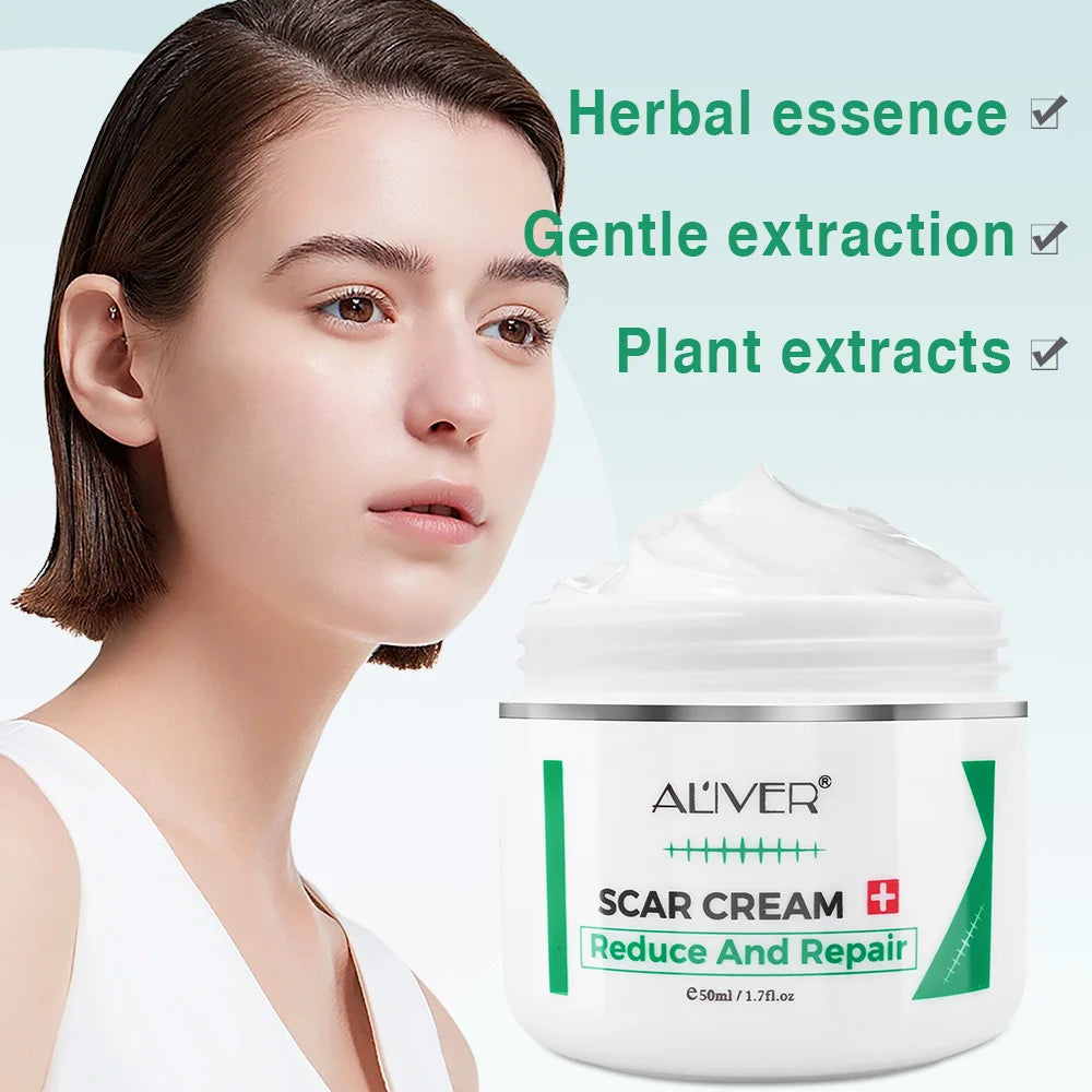 ALVER Acne Scar Stretch Marks Remover Cream Skin Repair Acne Black Dots Spots Acne Treatment Blackhead Bleaching Cream 50ml Oasis Select
