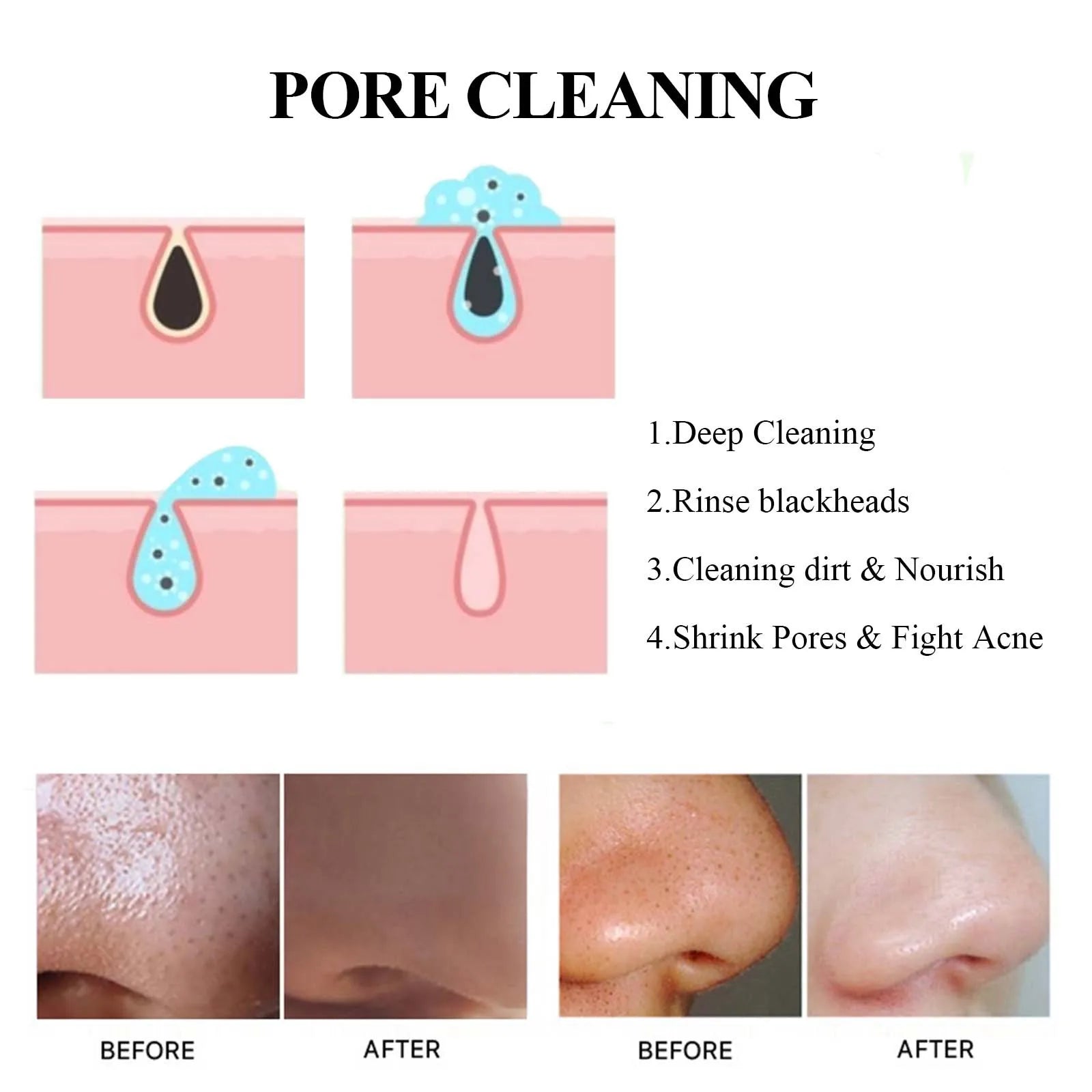 40g 4 pcs Blackhead Cleansing Mud Film, Dilute Acne and Acne Marks, Tighten Pores, Deeply Clean and Moisturize The Skin Oasis Select