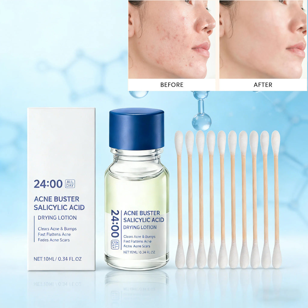 Salicylic Acid Acne Buster Remover Blackhead Oil Control Tenderizing Delicate Pores Pimple Spot Remover Facial Skin Care Essence Oasis Select