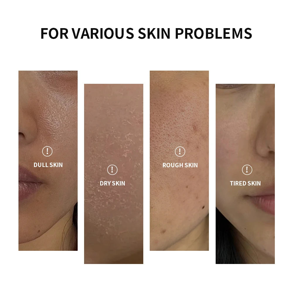 Probiotics Hydrating Cream Long-lasting Moisture Solve Dry Dull Skin Reduce Fine Lines Improve Skin Elasticity Skin Care Product Oasis Select