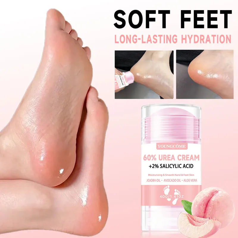 YOUNGCOME 60% Urea Foot Cream + Salicylic Acid | 40g Foot Cream Oasis Select
