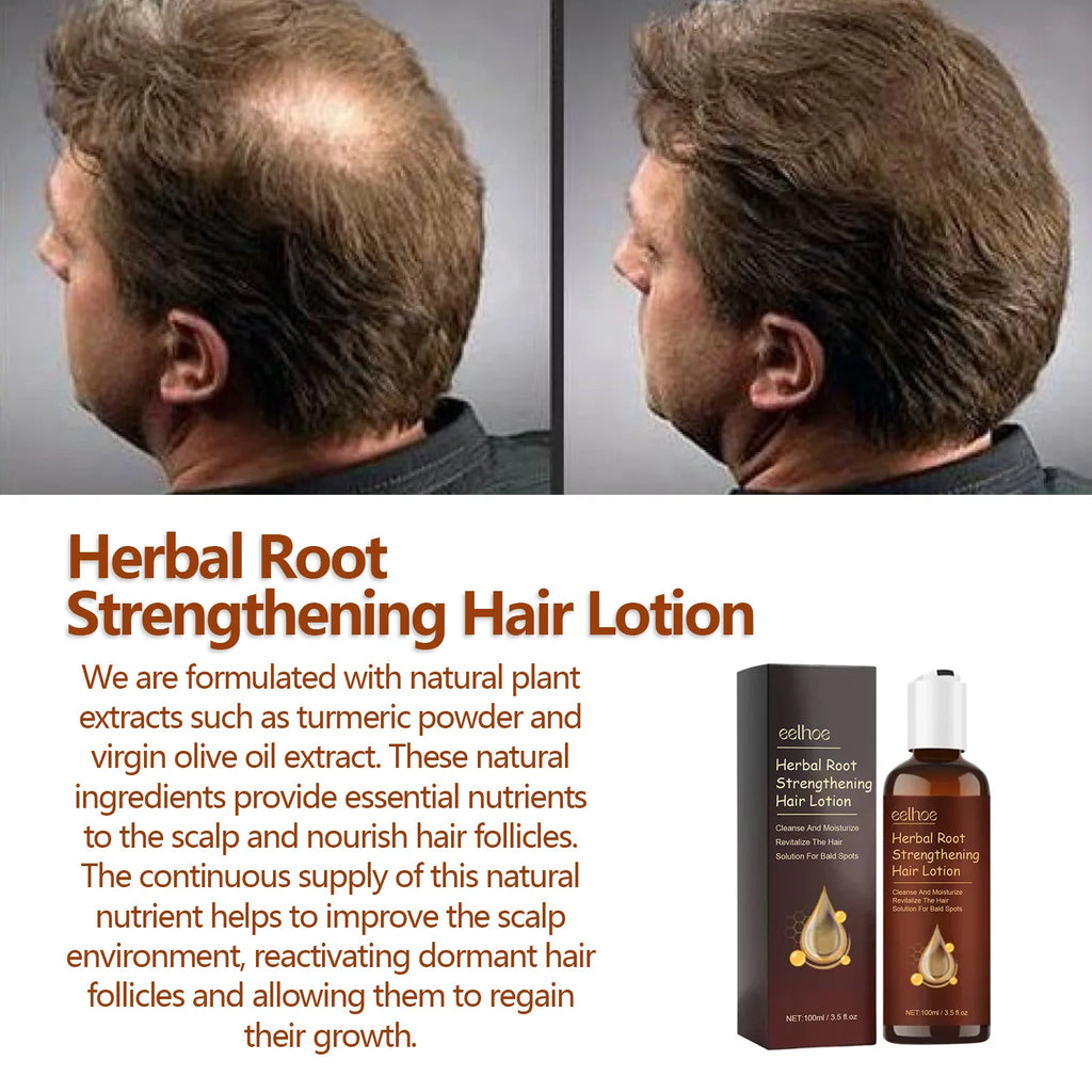 EELHOE Hair Growth Shampoo – Anti-Hair Loss & Scalp Repair Hair Growth Shampoo Oasis Select