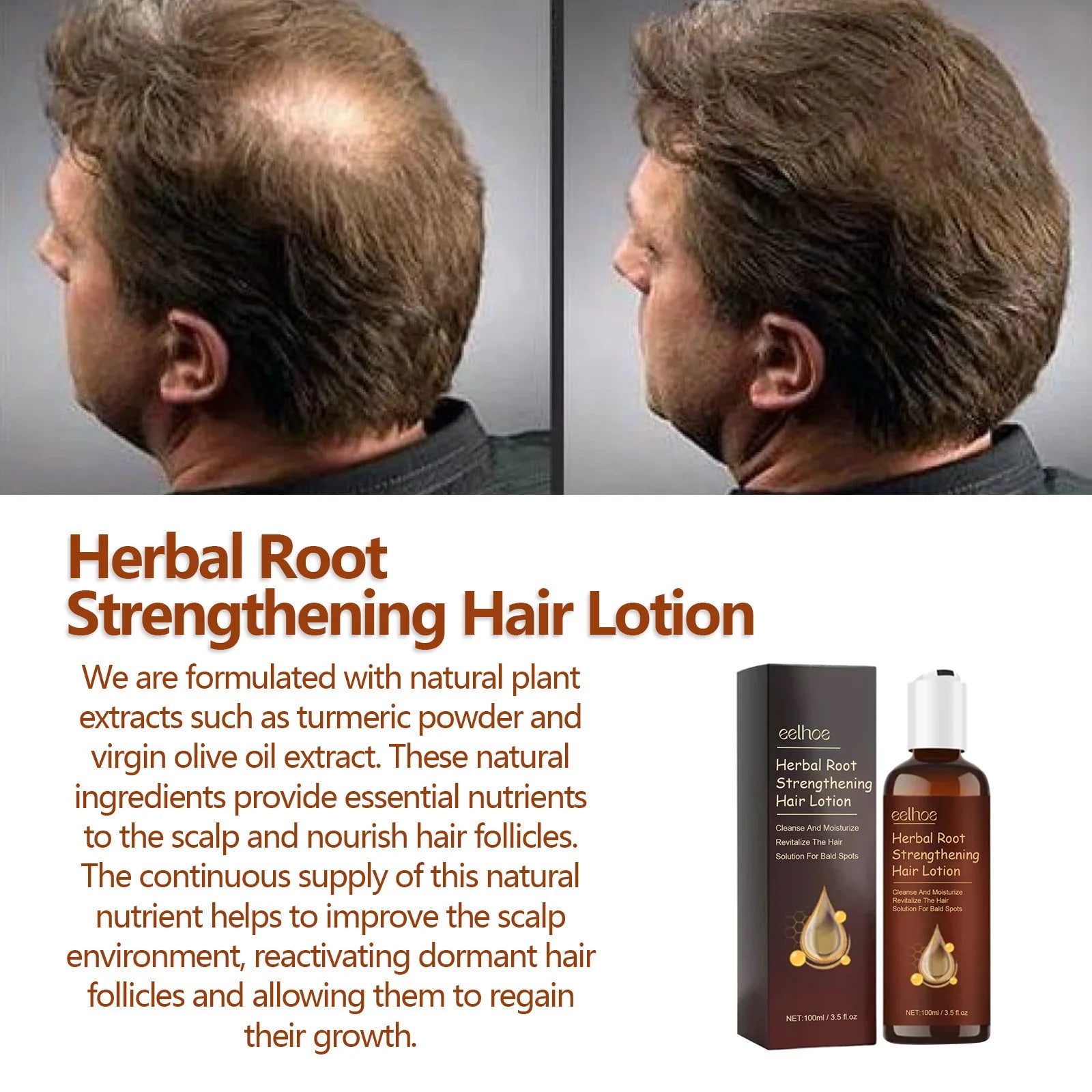 EELHOE Hair Growth Shampoo – Anti-Hair Loss & Scalp Repair Hair Growth Shampoo Oasis Select