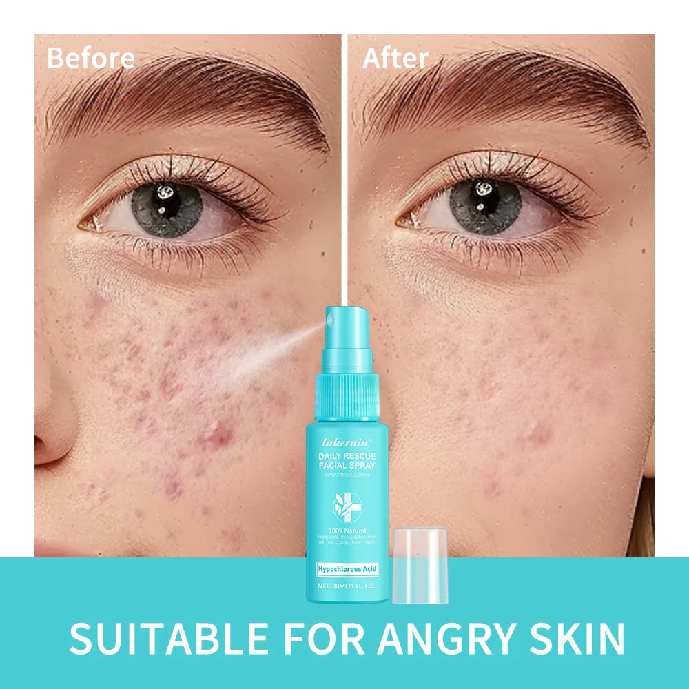Hypochlorous Acid pH Balancing Facial Toner Spray | 30ml