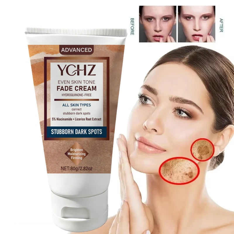 Niacinamide Dark Spot Brightening Cream – Even Skin Tone | 80g