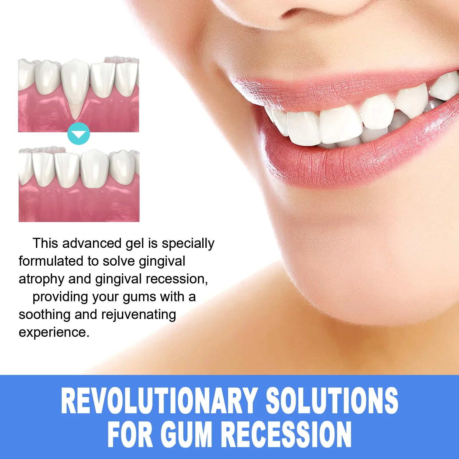 EELHOE Teeth Whitening Gel Gum Repair Treatment Dental Cleaning Teeth Bleaching Remove Stains Gum Repair Gel Oral Care Essence Oasis Select