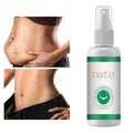 TRSTAY Slimming Essential Oil – Natural Herbal Body Firming