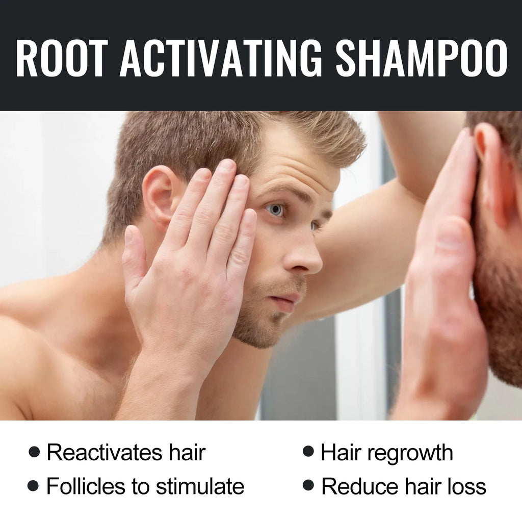 Eelhoe Shampoo – Anti-Dandruff, Oil Control & Hair Loss