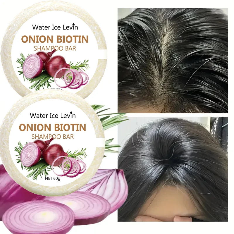 Onion & Biotin Shampoo Bar 60g – Rosemary, All Hair Types Solid Shampoo Bar Oasis Select