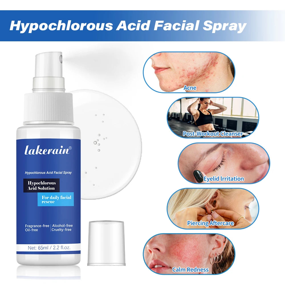 Hypochlorous Acid Facial Spray 65ml – Daily Skin Toner Mist