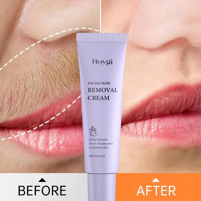 3 Minutes Fast Hair Removal Cream Painless Hair Growth Inhibitor Lip Face Arm Armpit Leg Permanent Depilatory for Men Women Care Oasis Select