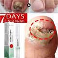 Nail Repair Serum – Foot & Toe Nail Restoration Oil Nail Repair Serum Oasis Select 1pc